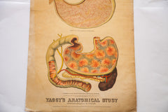 Antique 19th Century Anatomical Chart Yaggy's Alcohol Stomach // ONH Item 1803 Image 2