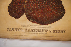 Antique 19th Century Anatomical Chart Yaggy's Stomach Opium Effects Alcohol // ONH Item 1805 Image 2
