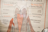 Detailed cross-section of a tooth showing enamel, dentine, and decay on a vintage medical diagram.