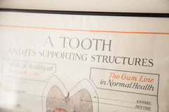 1920s Vintage Tooth Diagram Squibb Advertisement Poster // ONH Item 1533 Image 4