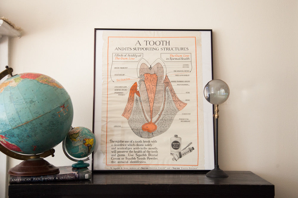 1920s Vintage Tooth Diagram Squibb Advertisement Poster // ONH Item 1533
