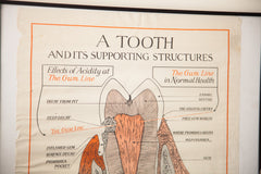 1920s Vintage Tooth Diagram Squibb Advertisement Poster // ONH Item 1533 Image 1