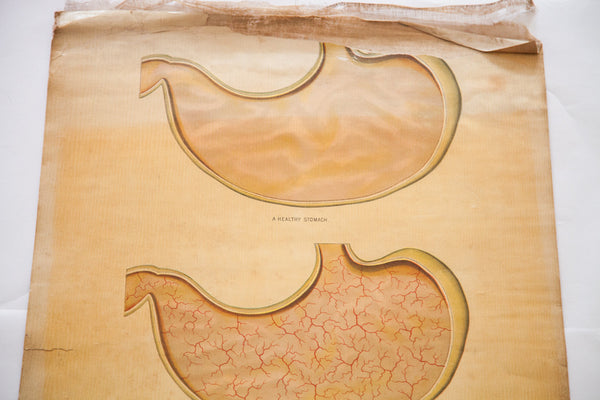 Antique 19th Century Anatomical Chart Yaggy's Alcohol Stomach // ONH Item 1803 Image 3