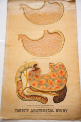 Yaggy's 1885 Anatomical Study chart showing the alcohol-damaged stomach and copyright.