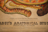 Detail of 1885 Yaggy's antique chart, showing 'Stomach after continuous drinking' text.