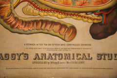 Antique 19th Century Anatomical Chart Yaggy's Alcohol Stomach // ONH Item 1803 Image 1