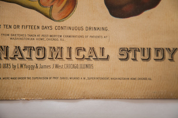 Antique 19th Century Anatomical Chart Yaggy's Alcohol Stomach // ONH Item 1803 Image 5