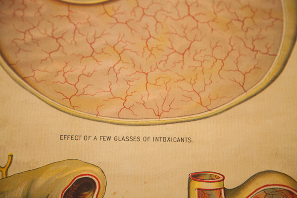 Antique 19th Century Anatomical Chart Yaggy's Alcohol Stomach // ONH Item 1803 Image 6