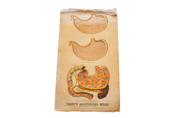 Antique 19th Century Anatomical Chart Yaggy's Alcohol Stomach // ONH Item 1803