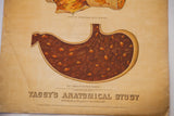 Antique 19th century Yaggy's chart detail with stomach, 'Delirium Tremens' text, 1885 copyright.