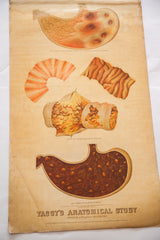 Yaggy's 1885 anatomical chart bottom showing Delirium Tremens diagram and aged paper.
