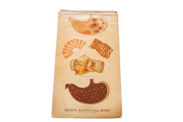 Antique 19th Century Anatomical Chart Yaggy's Intestines Delirium Tremens // ONH Item 1804
