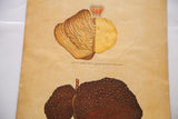 Yaggy's 19th century chart: cerebellum with alcohol effects and mottled hob-nailed liver.
