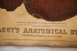 Yaggy's 1885 antique anatomical chart text detailing hob-nailed liver and aged paper condition.