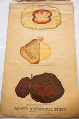 Textured red-brown hob-nailed liver detail on the yellowed antique Yaggy's anatomical chart.
