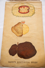 Antique 19th Century Anatomical Chart Yaggy's Stomach Opium Effects Alcohol // ONH Item 1805 Image 4